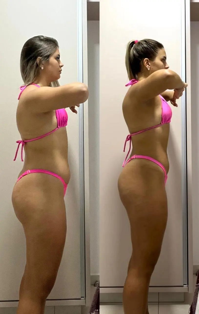 Before and After 5