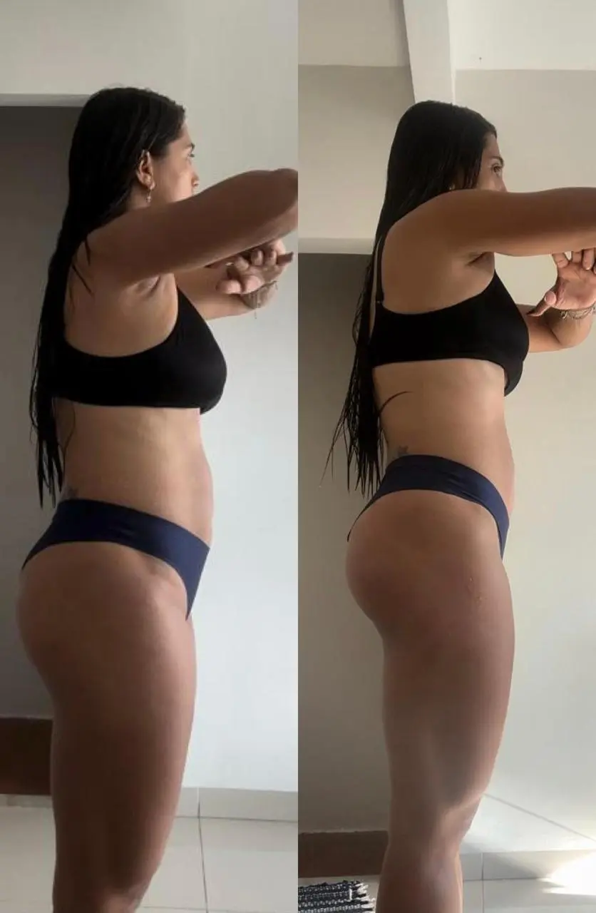 Before and After 6